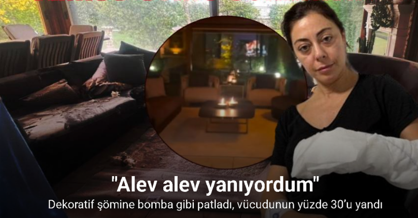 Dekoratif şömine bomba gibi patladı, vücudunun yüzde 30’u yandı: 