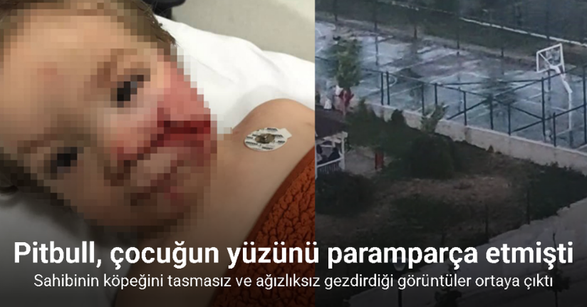 Ankara’da iki kardeşe saldıran pitbullun sahibinin, köpeğini tasmasız ve ağızlıksız gezdirdiği görüntüler ortaya çıktı