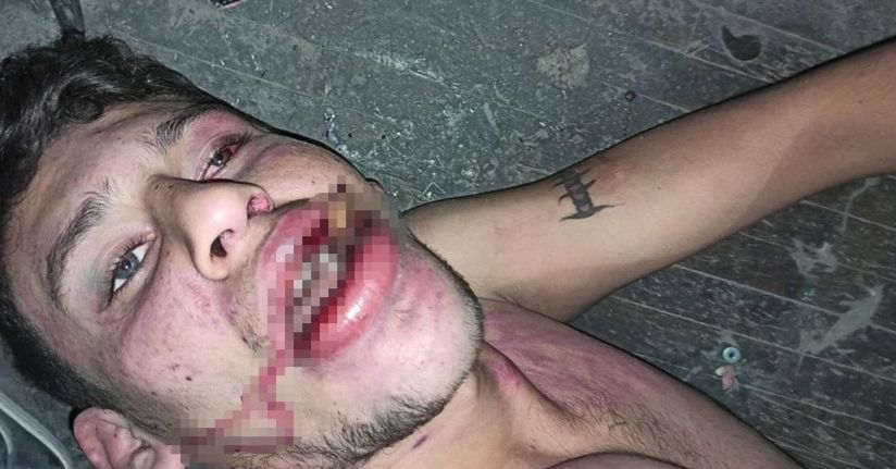 Hamam böceği yedirilen gencin dosyasında karar: Yağmadan beraat, hürriyeti tehditten 6 yıl 12 ay ceza