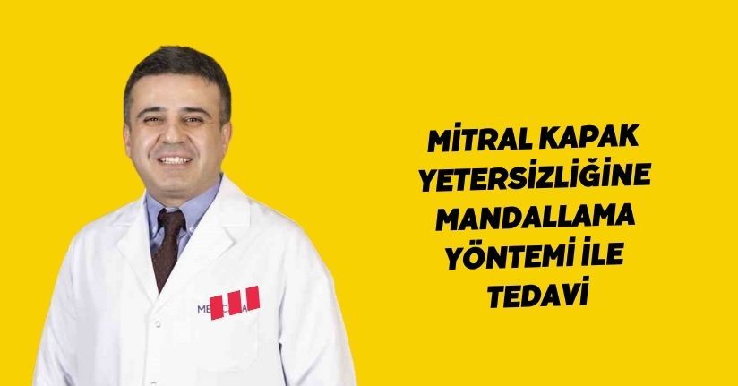 Mitral kapak yetersizliğine mandallama yöntemi ile tedavi