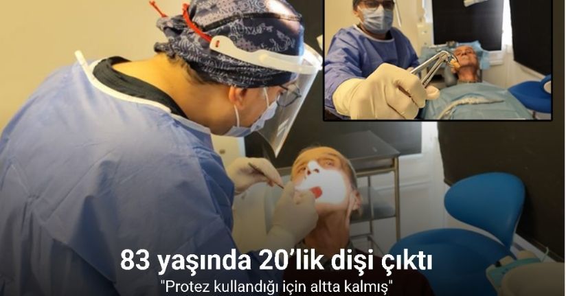 83 yaşında 20’lik dişi çıktı
