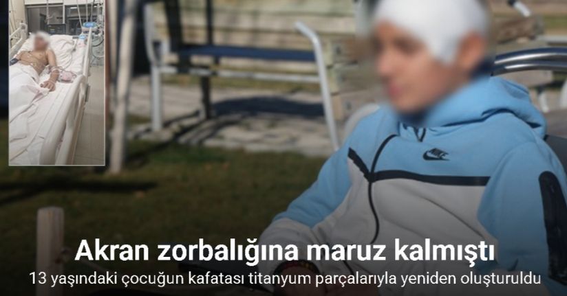 Akran zorbalığına maruz kalan 13 yaşındaki çocuğun kafatası titanyum parçalarıyla yeniden oluşturuldu