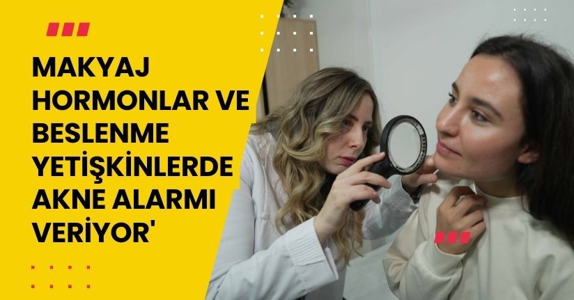 'Makyaj, hormonlar ve beslenme yetişkinlerde akne alarmı veriyor'