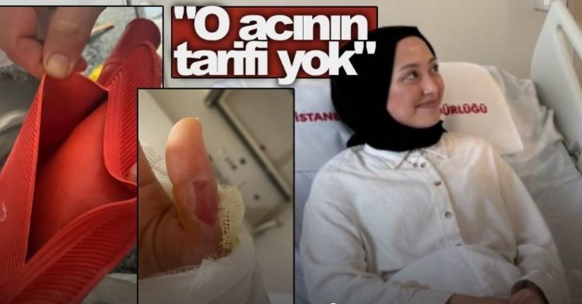Sıcak su torbası patladı, genç kızın vücudunun yüzde 25’i yandı: 