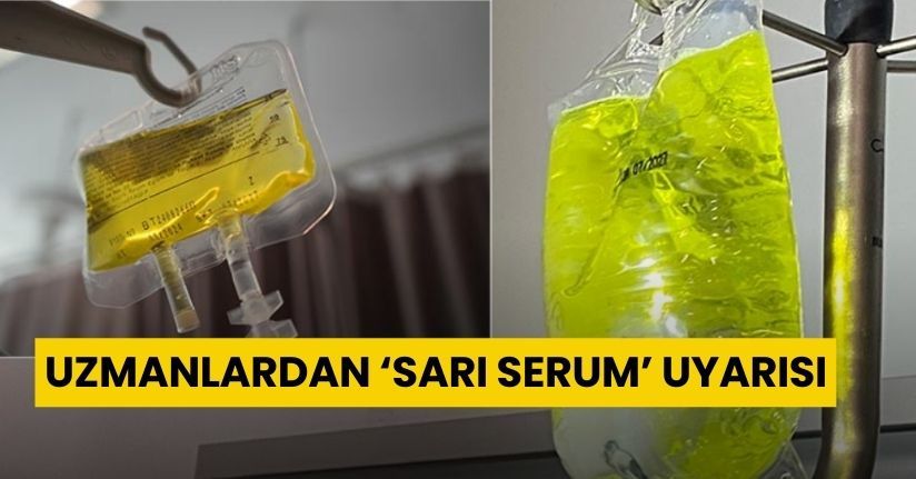 Uzmanlardan ‘sarı serum’ uyarısı