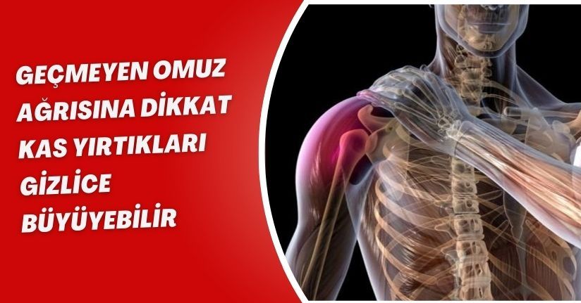 Geçmeyen omuz ağrısına dikkat: Kas yırtıkları gizlice büyüyebilir