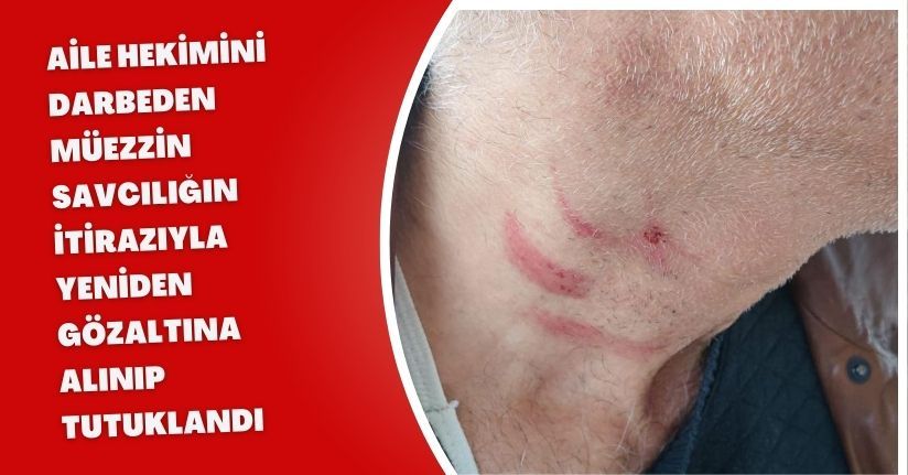 Aile hekimini darbeden müezzin, savcılığın itirazıyla yeniden gözaltına alınıp tutuklandı