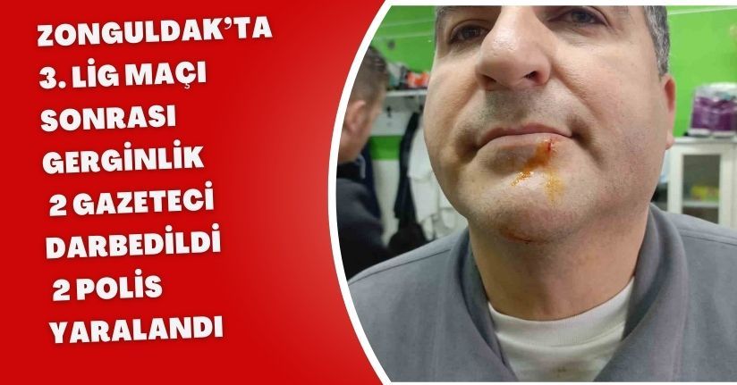 Zonguldak’ta 3. Lig maçı sonrası gerginlik: 2 gazeteci darbedildi, 2 polis yaralandı