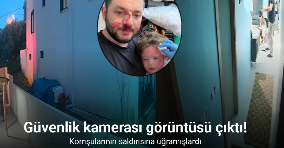 Yalova’da 14 aylık bebeğin yaralandığı komşu kavgası güvenlik kamerasına yansıdı