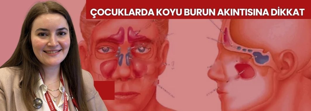 Çocuklarda Koyu Burun Akıntısına Dikkat