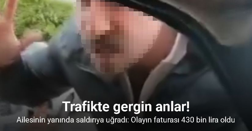 Ailesinin yanında saldırıya uğradı: Olayın faturası 430 bin lira oldu