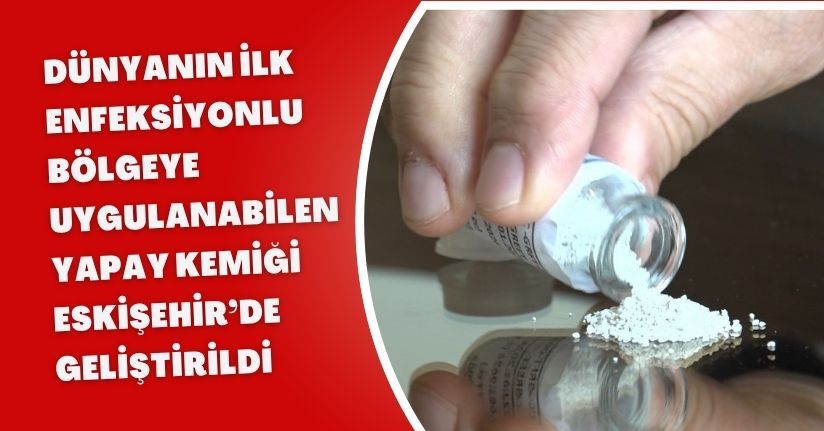 Dünyanın ilk enfeksiyonlu bölgeye uygulanabilen yapay kemiği Eskişehir’de geliştirildi