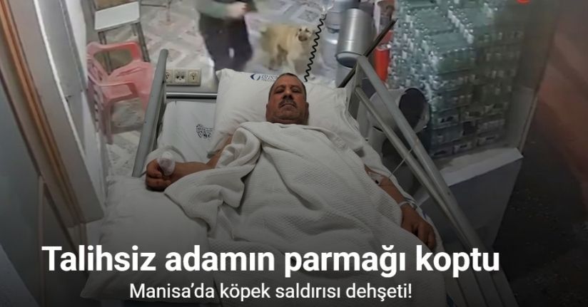 Başıboş köpeklerin saldırısına uğrayan adamın baş parmağı koptu