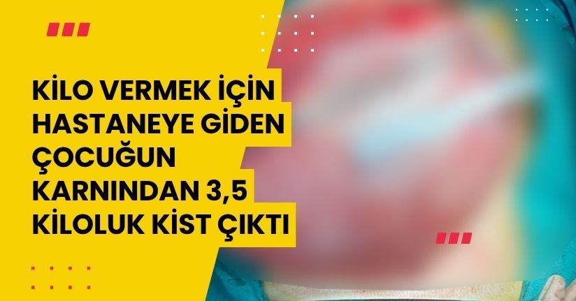 Kilo vermek için hastaneye giden çocuğun karnından 3,5 kiloluk kist çıktı