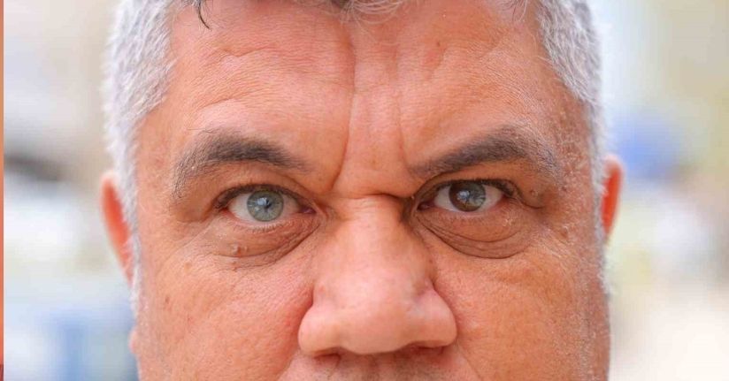 Kahramanmaraşlı adam 3 renkli gözleriyle görenlerin ilgisini çekiyor