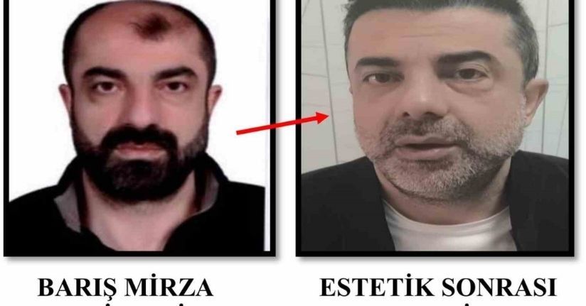 Ameliyat ile yüzünü değiştiren firari cinayet zanlısı, 7 yıl sonra yakalandı