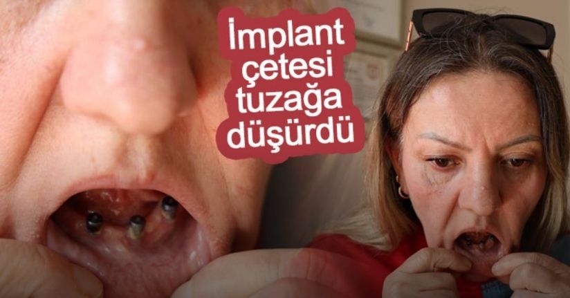 Diş ağrısı şikayetiyle gitti 25 dişinden oldu