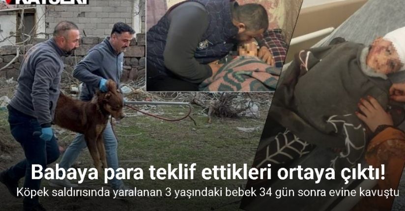 Köpek saldırısında yaralanan 3 yaşındaki bebek 34 gün sonra evine kavuştuKöpek saldırısında yaralanan 3 yaşındaki bebek 34 gün sonra evine kavuştu