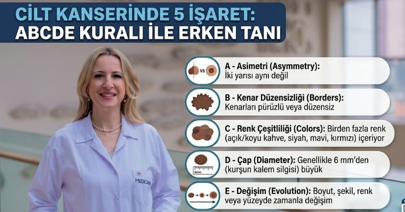 Cilt kanserinde 5 işaret: ABCDE kuralı ile erken tanı