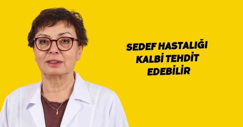 Sedef hastalığı kalbi tehdit edebilir