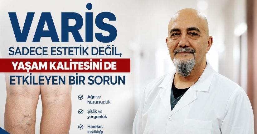 Varis sadece estetik değil, yaşam kalitesini de etkileyen bir sorun