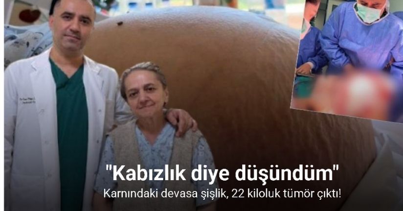Karnındaki devasa şişlik 22 kiloluk tümör çıktı: 