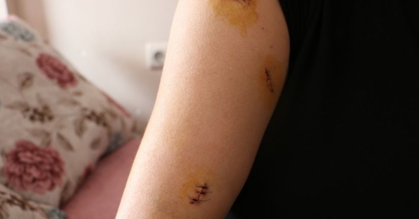 Kocası tarafından 30 yerinden bıçaklandı, görümcesi şikayetini geri çekmesini istedi