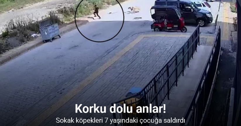 Sokak köpeklerinin saldırdığı 7 yaşındaki çocuk korku dolu anlar yaşadı