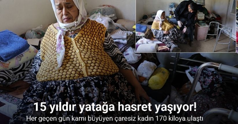 Her geçen gün karnı büyüyen çaresiz kadın 170 kiloya ulaştı, artık hareket edemiyor