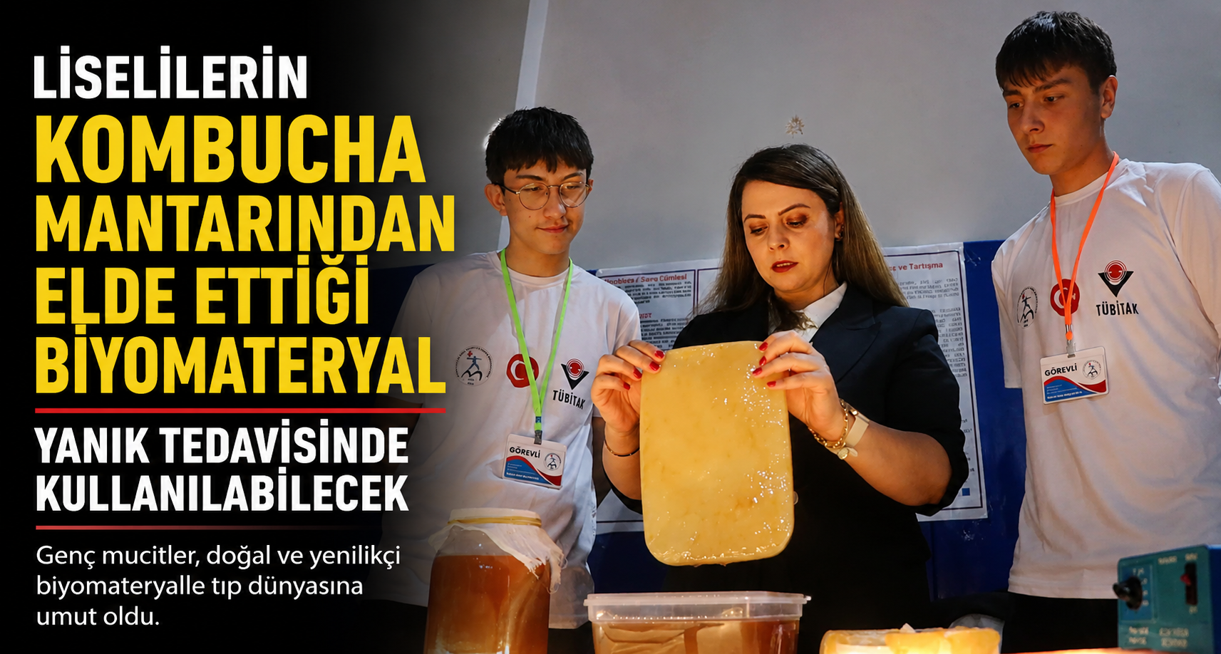 Liselilerin kombucha mantarından elde ettiği biyomateryal yanık tedavisinde kullanılabilecek
