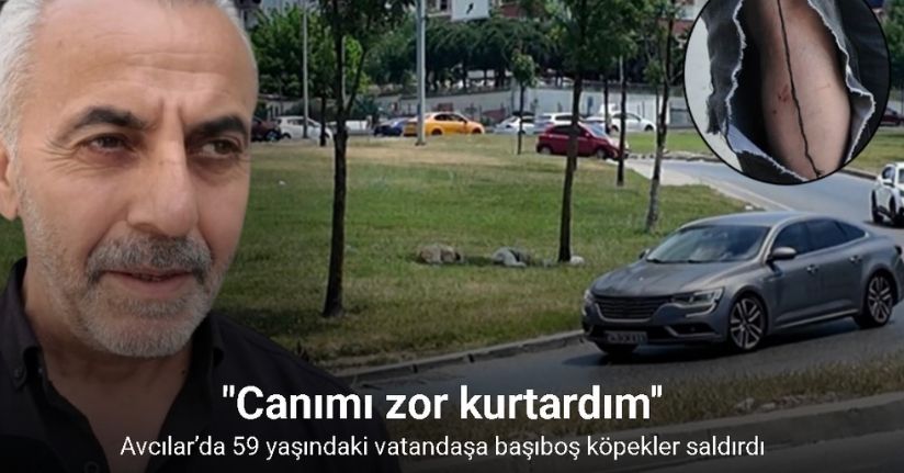 Avcılar’da 59 yaşındaki vatandaşa başıboş köpekler saldırdı