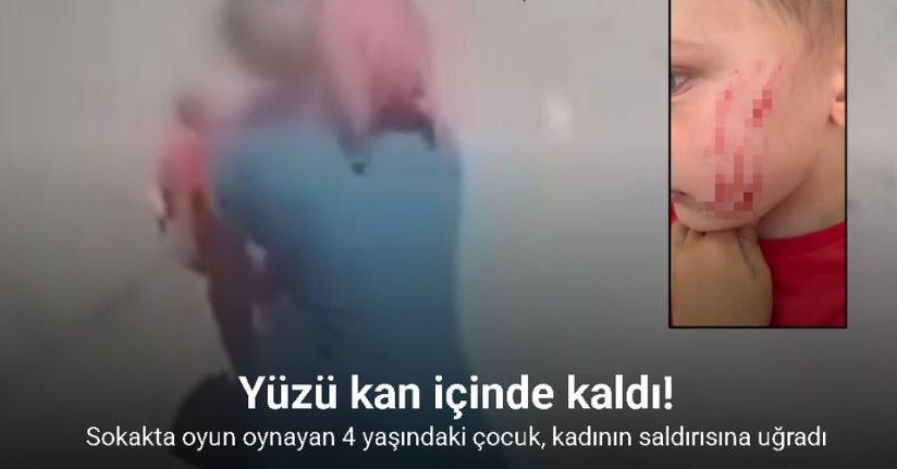 Van’da sokakta oynayan çocuğa saldırı: O anlar kamerada