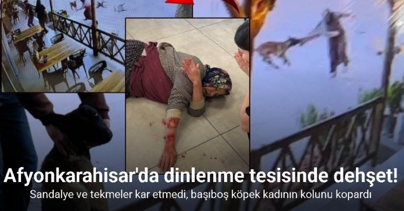 Tekmelere aldırmayan köpek kadının kolunu kopardı