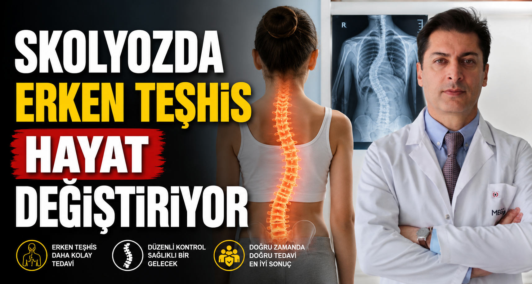 Skolyozda erken teşhis hayat değiştiriyor