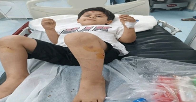 Sokak köpeklerinin saldırısına uğrayan Abdulkadir, yaralandı