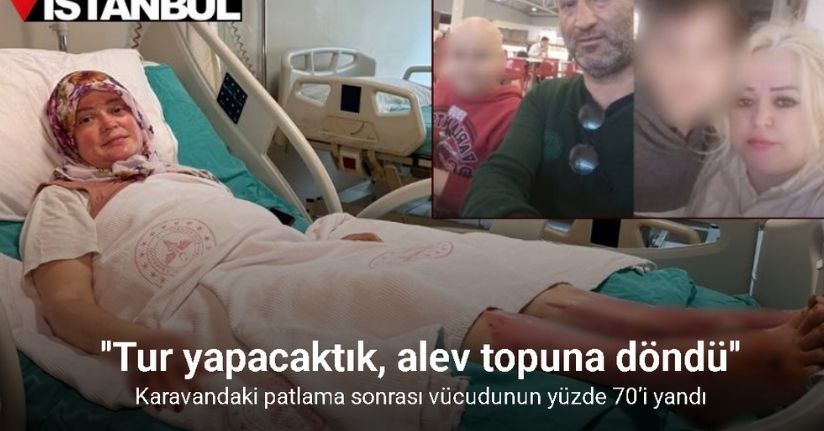 Karavandaki patlama sonrası vücudunun yüzde 70’i yandı