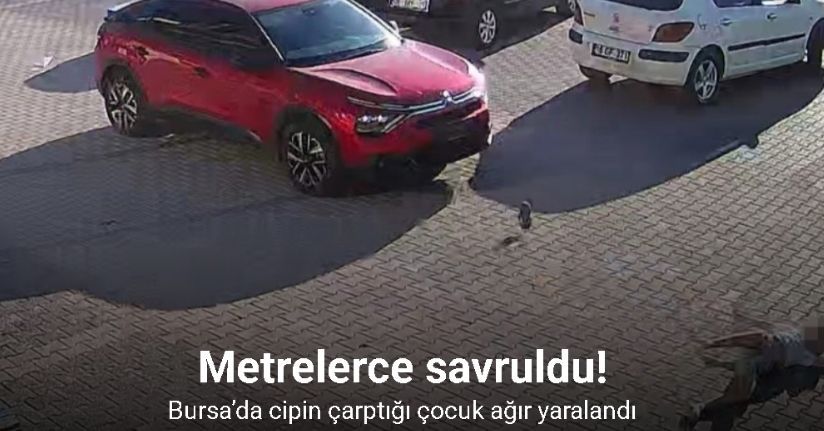 Bursa’da cipin çarptığı çocuk ağır yaralandı
