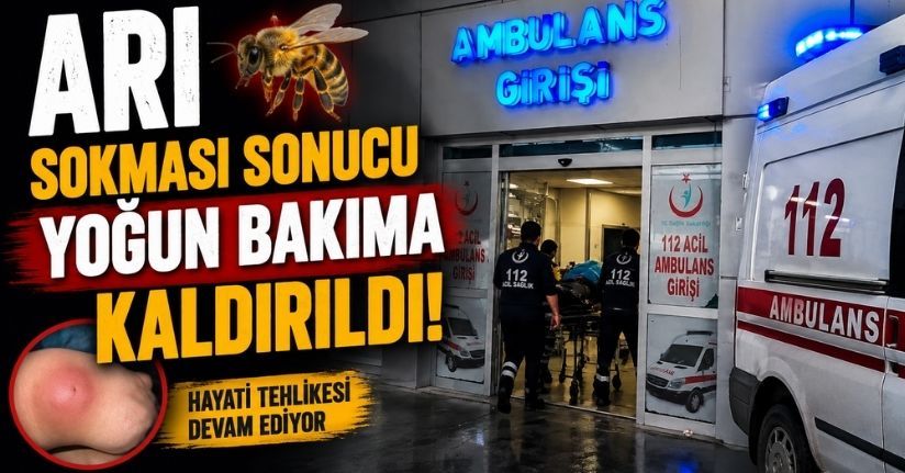 Arı sokması sonucu yoğun bakıma kaldırıldı