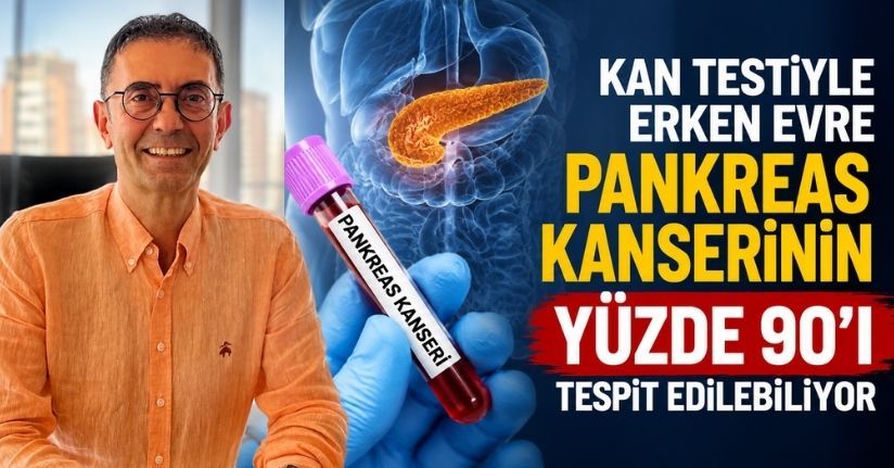 Kan testiyle erken evre pankreas kanserinin yüzde 90’ı tespit edilebiliyor