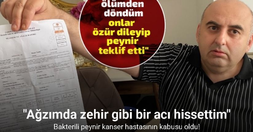 Bakterili peynir kanser hastasının kabusu oldu: 