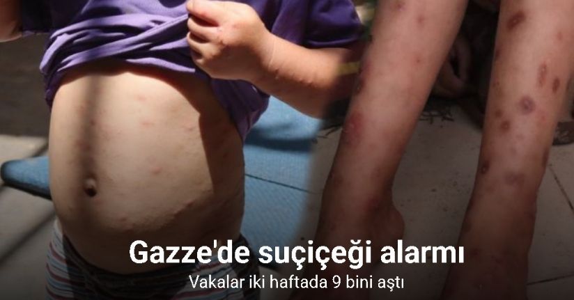 Gazze'de suçiçeği alarmı: Vakalar iki haftada 9 bini aştı