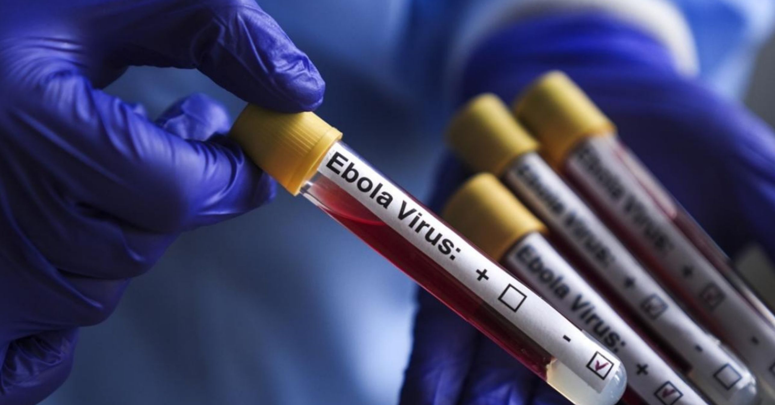 Kongo Demokratik Cumhuriyeti'nde Ebola salgınında vaka sayısı 3 bini aştı