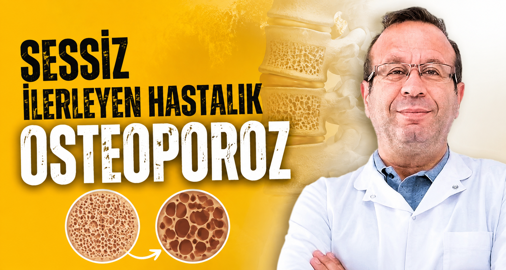 Sessiz ilerleyen hastalık osteoporoz