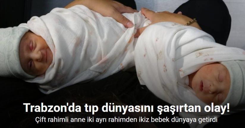 Milyonda bir görülen doğum olayı Trabzon’da gerçekleşti