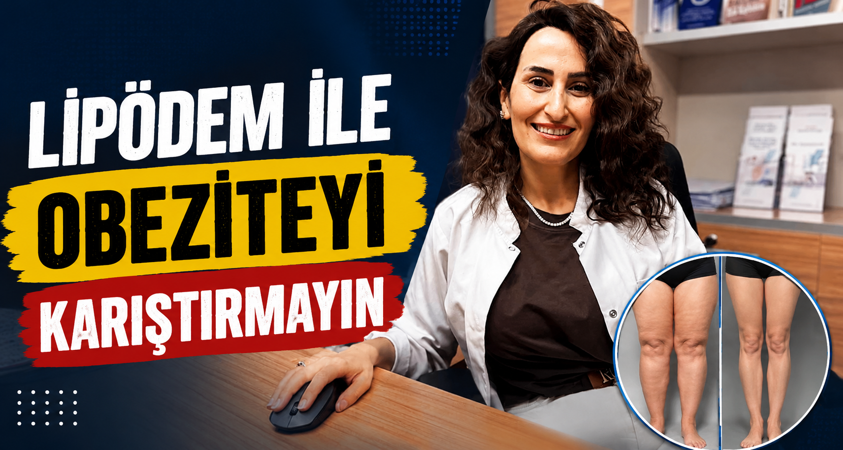 Lipödem ile obeziteyi karıştırmayın