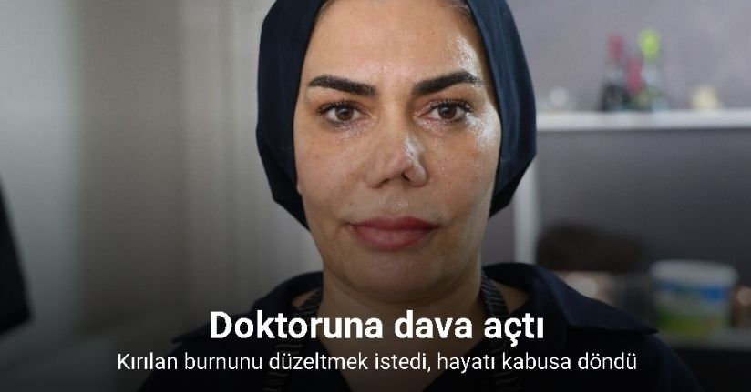 Bakım merkezinde burnu kırıldı, iyileşmek için geçirdiği 4 operasyon sonrası hayatı kabusa döndü