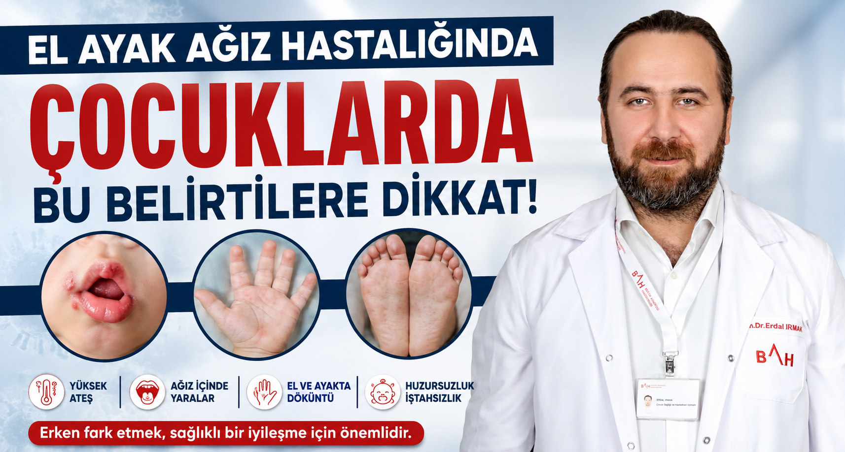 El ayak ağız hastalığında çocuklarda bu belirtilere dikkat