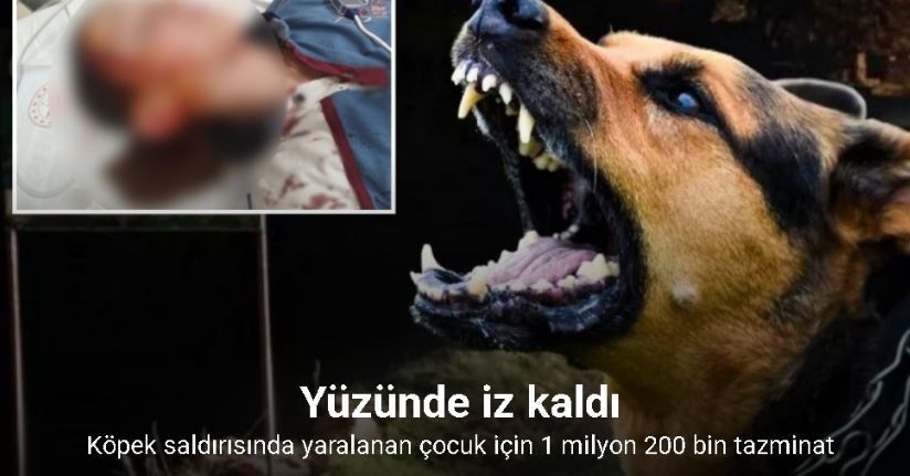 Köpek saldırısında yaralanan çocuk için 1 milyon 200 bin tazminat