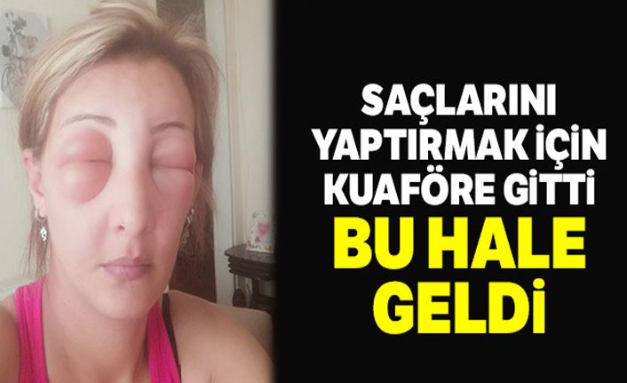 Saçlarını yaptırmak için kuaföre gitti, canından oluyordu