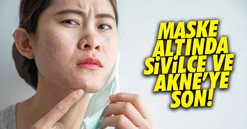 Maske altında çıkan sivilcelenmeye son